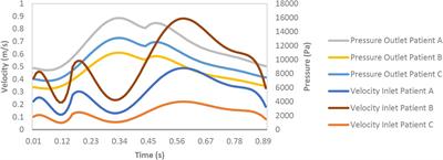 Study of Coronary Atherosclerosis Using Blood Residence Time